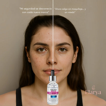 Sérum facial con Ácido Kójico + Colágeno